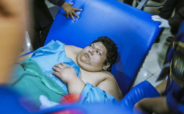 Pria Obesitas 330 Kilogram Meninggal Dunia
