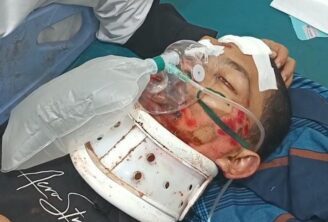 Korban pelemparan helm oleh anggota Polda Banten kritis di rumah sakit.